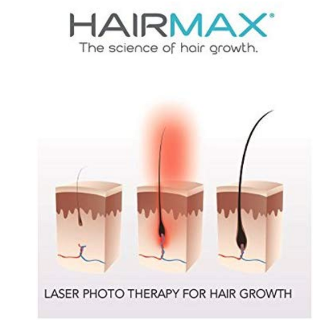 新低！FDA认证、刺激毛发生长！HairMax Ultima 12 雷射健发梳 prime到手约1999元（之前推荐2269.8元、天猫4580元） 买手党-买手聚集的地方
